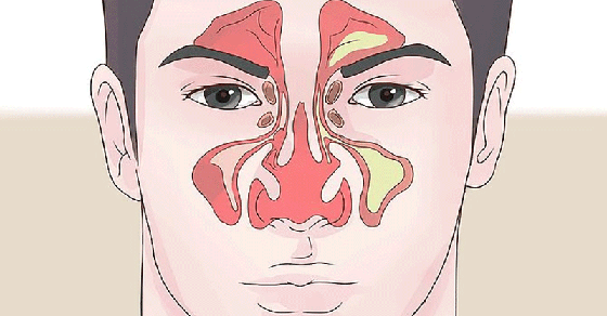 How to Clear a Stuffy Nose in 1 Minute
