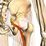 Top 10 Sciatic Pain Natural Treatments image-4015