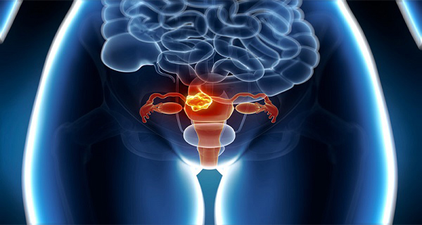 28 Year Old Mother Died Due To Uterus Cancer – These Are The Symptoms She Ignored