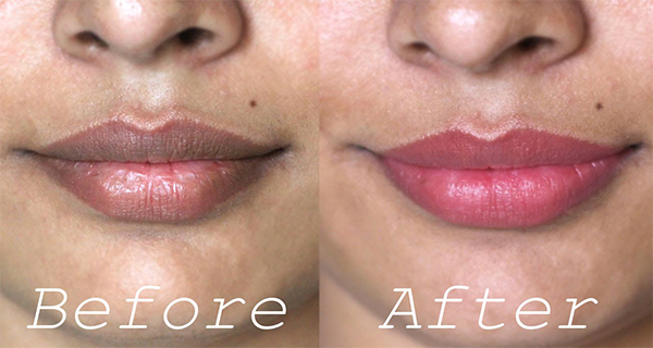 This Is How To Whiten Dark Lips Naturally!