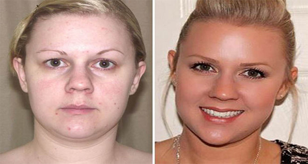 Woman Lost 27 Pounds And Solved Her Skin Problems When She Stopped Eating Only A Few Foods!