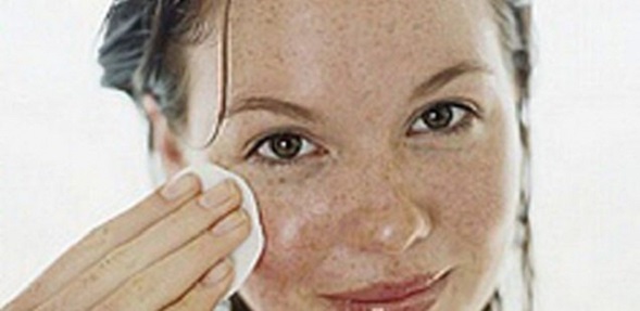 Homemade Remedy to Get Rid of Freckles