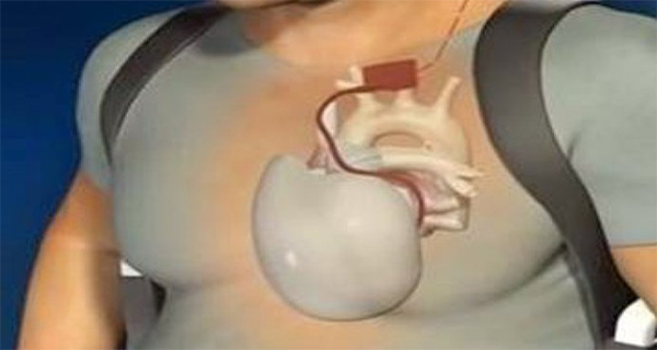 This 800 Years Old Remedy Will Solve All Your Heart Problems