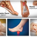 5 Foot Exercises To Relieve Back, Hip, And Knee Pain In 20 Minutes or Less image-6485