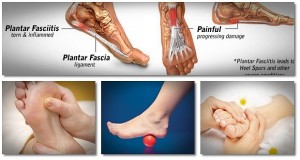 5 Foot Exercises To Relieve Back, Hip, And Knee Pain In 20 Minutes or Less image-6485