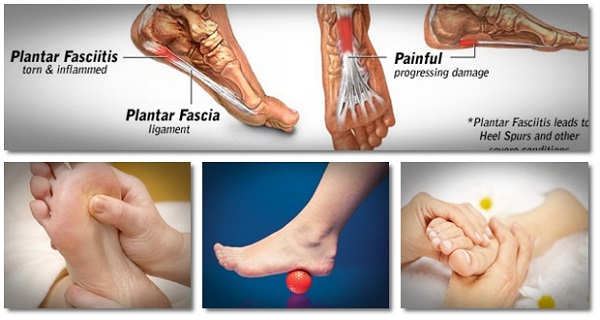 howtogetridofplantarfasciitisplantarfasciitissecretsrevealedhelp