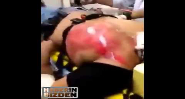 He-Drank-24-Energy-Drinks-and-His-Heart-Was-Going-To-Blow