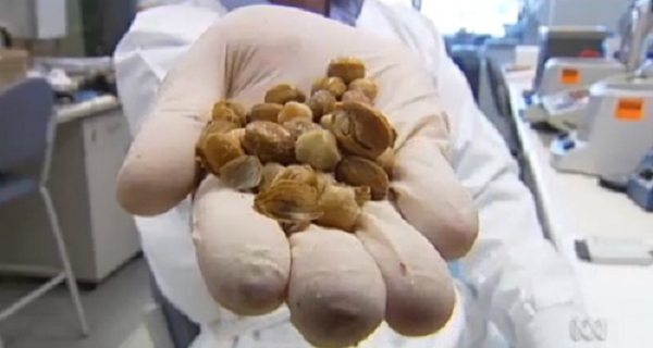 Amazing Discovery This Fruit Kills Cancer After Just a Few Minutes! (VIDEO)