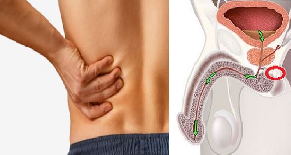 Do I Have Prostate Cancer 12 Early Symptoms Men Should Never Ignore