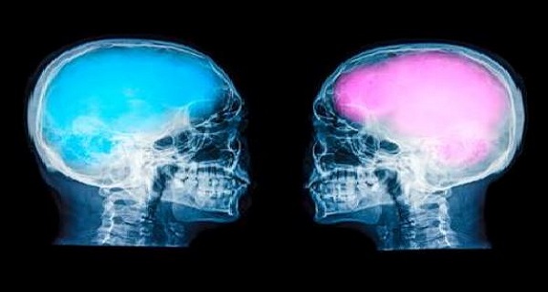 THIS POISON DESTROYS YOUR BONES. BUT EVERYONE DRINKS IT, SOME DAILY!