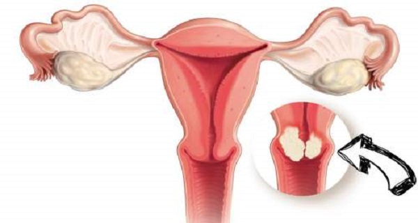 Top 10 Herbs that Can Boost Your Cervical Health!