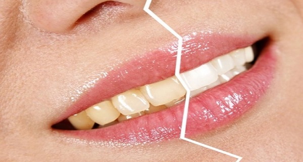 Who Says it is Not Possible to Have a Smile like a TV-Star Mix Two Ingredients and Expect Miracle!
