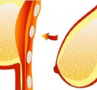 A NATURAL WAY TO AVOID HAVING SAGGY BREASTS