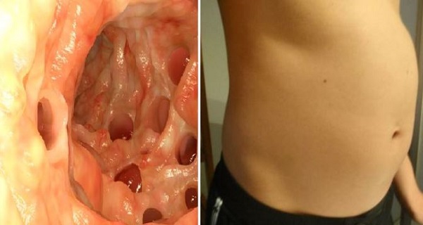 Do You Have Bloated Stomach Warning Signs You Should Never Ignore!