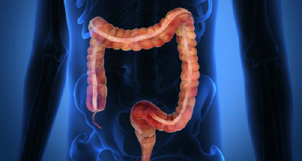 How to Clean The 5 Kilos of Poisons That we Have in The Colon