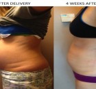 Lose Baby Weight - Here is How to Lose Weight after Pregnancy