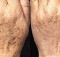 Remove Age Spots With The Best Homemade Exfoliating Scrub!
