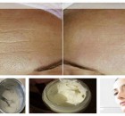 Anti-Aging Homemade Cream to Get Rid of Lines and Wrinkles on Your Face in Less Than Two Weeks