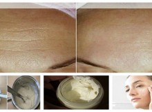 Anti-Aging Homemade Cream to Get Rid of Lines and Wrinkles on Your Face in Less Than Two Weeks