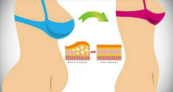 Best Exercises to Lose Stomach Fat at Home