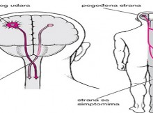 DOCTORS RECOMMEND THIS REMEDY PREVENTS HEART ATTACK AND STROKE, KILLS CHOLESTEROL, AND STRENGHTENS THE IMMUNE SYSTEM!