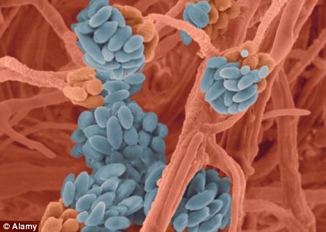Drying Laundry Inside Can Pose a Serious Health Threat. People with Weakened Immune System, Asthma and Allergies are Particularly at Risk 1