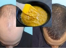 Extremely Effective Homemade Mask for Hair Growth!