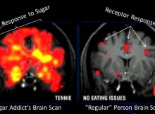 This Is How Sugar DESTROYS the Brain