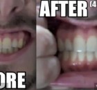 Use This Herb To Naturally Whiten Teeth( Video)