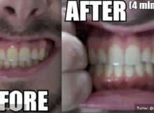 Use This Herb To Naturally Whiten Teeth( Video)