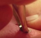 WHEN A BLACK SPOT APPEARED ON HIS BODY HE WENT STRAIGHT TO THE DOCTOR AND THEN THE UNSPEAKABLE FOLLOWS (VIDEO)