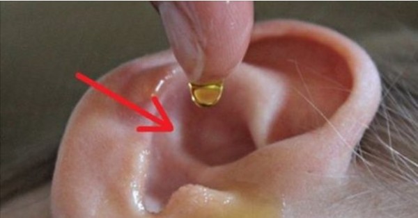 ear-e1442039712388