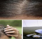 5 Minutes to Get Rid of White Hair and Regrow Hair Naturally