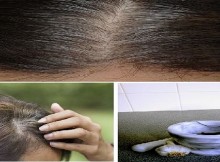 5 Minutes to Get Rid of White Hair and Regrow Hair Naturally