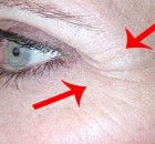 Apply This One Ingredient and Get Rid of Crow's Feet and Fine Lines around Your Eyes