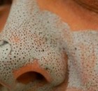 Get Rid of Blackheads and Make Your Face Shine with This Amazing Home Remedy
