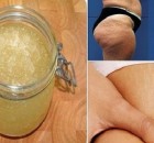 Get Rid of Stretch Marks and Cellulite Forever Using This 2-Ingredient Homemade Exfoliator