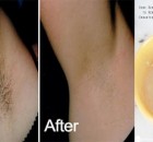 Removing-Underarm-Hairs-In-Just-2-Minutes