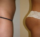 This One Exercise Will Tone Even the Flattest Glutes in Less Than a Month. Spare One Minute a Day and Get Perfectly Toned Buttocks