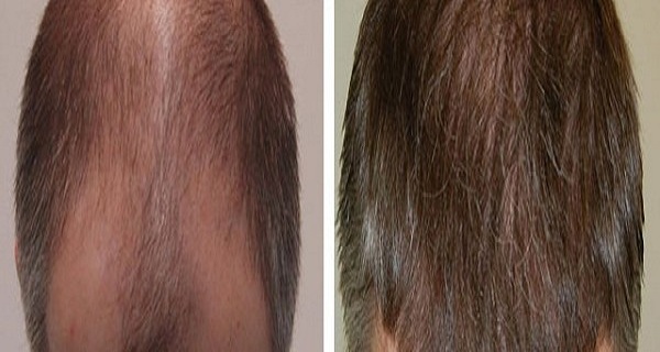 This Recipe Will Make Your HAIR Grow Faster and Longer