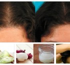 Why Onion Juice Is Extremely Beneficial for Hair Growth