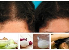 Why Onion Juice Is Extremely Beneficial for Hair Growth