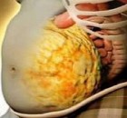 Speed-Up-Your-Metabolism-and-Remove-Toxins-from-Your-Body