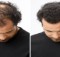 The Magic Homemade Recipe for Fastest Hair Growth! 3 Ingredients Only