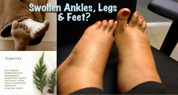 Best Eos For Swollen Ankles, Legs & Feet