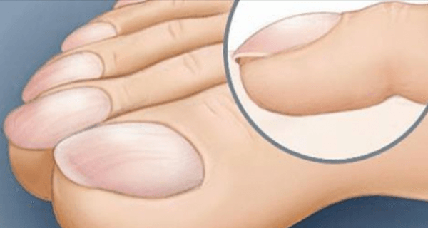 Early-Symptoms-of-Liver-Damage-that-Everybody-Ignores