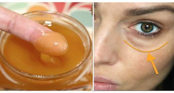Apply This Mixture On The Dark Circles Under Your Eyes And Wake Up Without Them! Results Guaranteed!