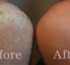 How To Clean Your Feet With Baking Soda It’s Very Easy. Try This, The Results Are Incredible!!!