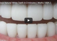 How To Have White Teeth Naturally At Home In Just 3 Minutes