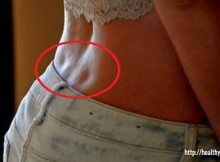 If you have these two holes on your back you're special